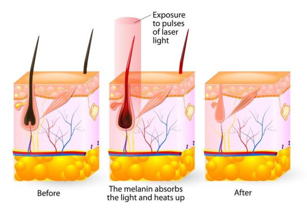 image1-600x410